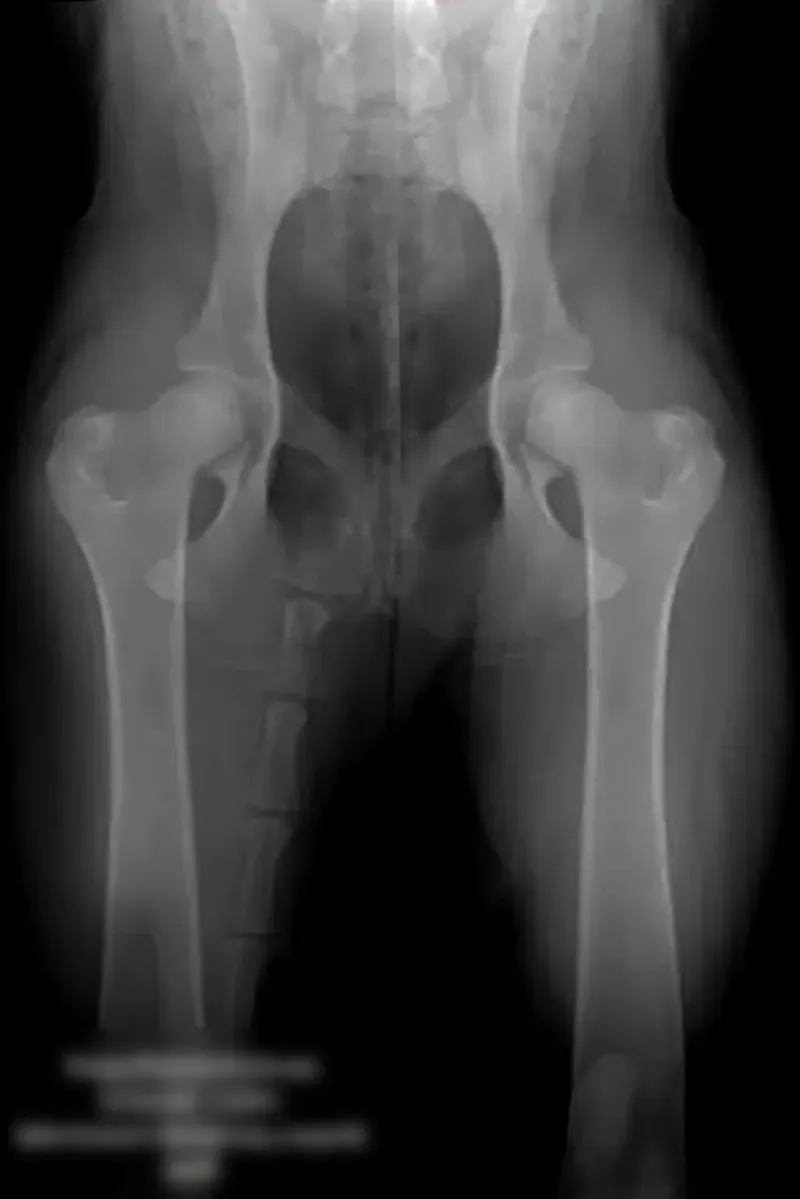 Radiographie d'une hanche dans le cadre d'un dépistage de la dysplasie