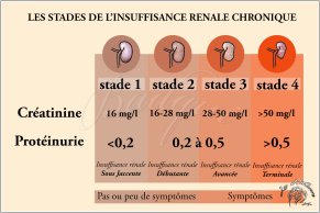 Les stades de l'insuffisance rénale chronique